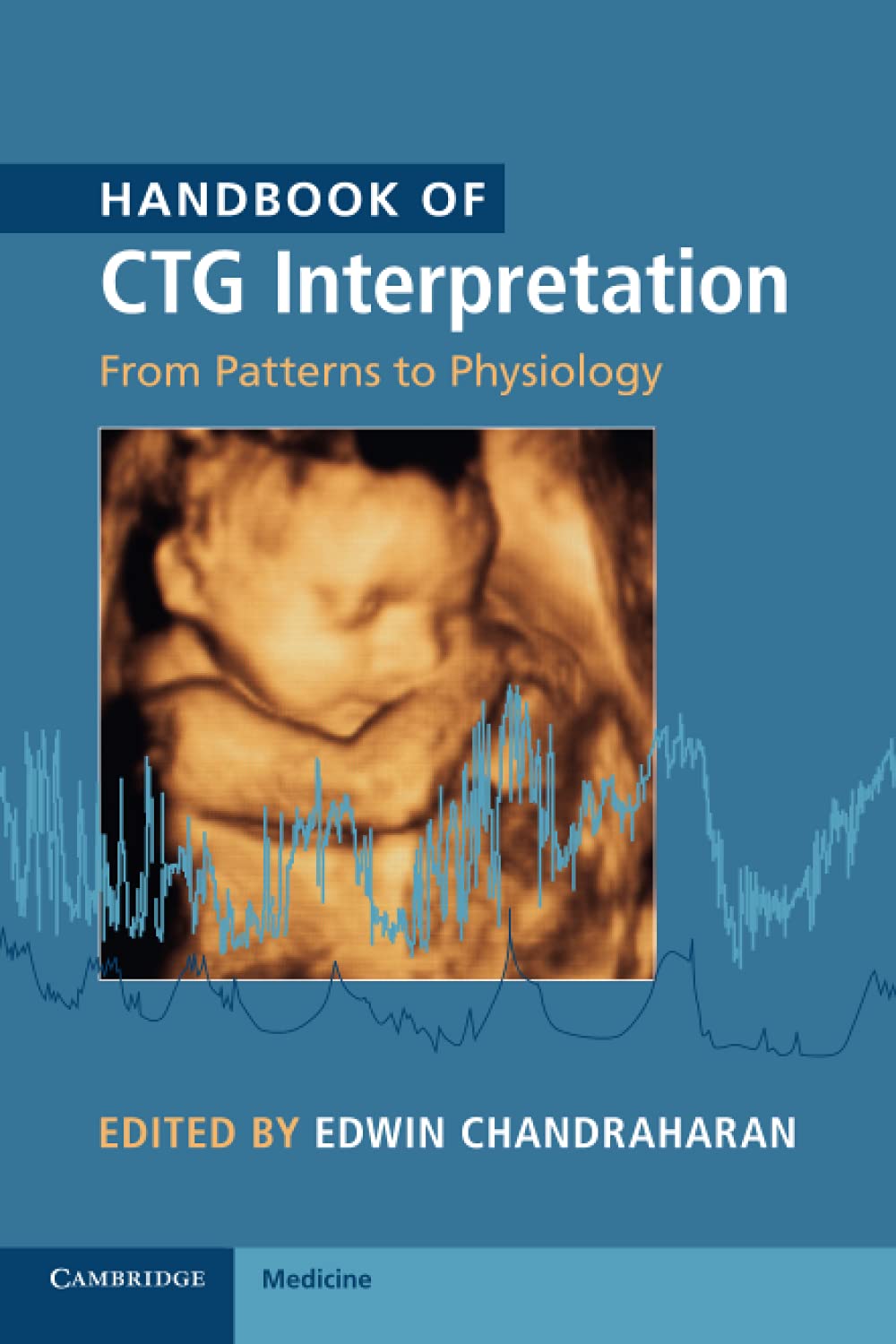 Handbook of CTG Interpretation: From Patterns to Physiology Paperback – 23 Feb. 2017