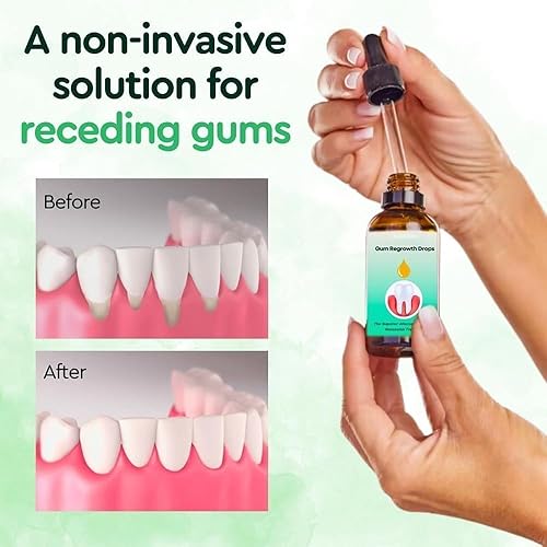 Miniatura 2 de Gotas de alivio de encías, gotas de crecimiento de las encías DentiZen, para jalar con aceite de encías para dientes y encías, 2 unidades