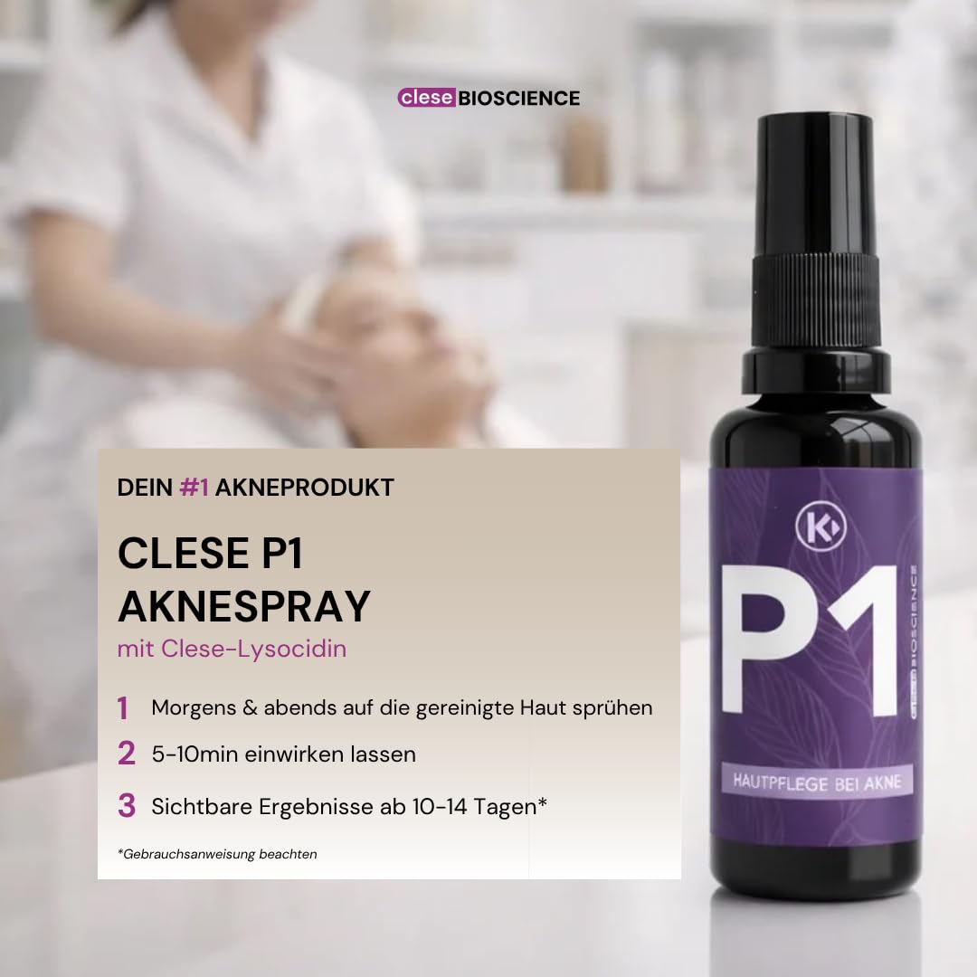 clese P1® Akne‑Spray 50 ml – 100% veganes Anti‑Pickel Hautspray | Auch für hormonelle Akne geeignet | Sanfte Akne Behandlung ohne Alkohol & schädliche Inhaltsstoffe | Made in Germany