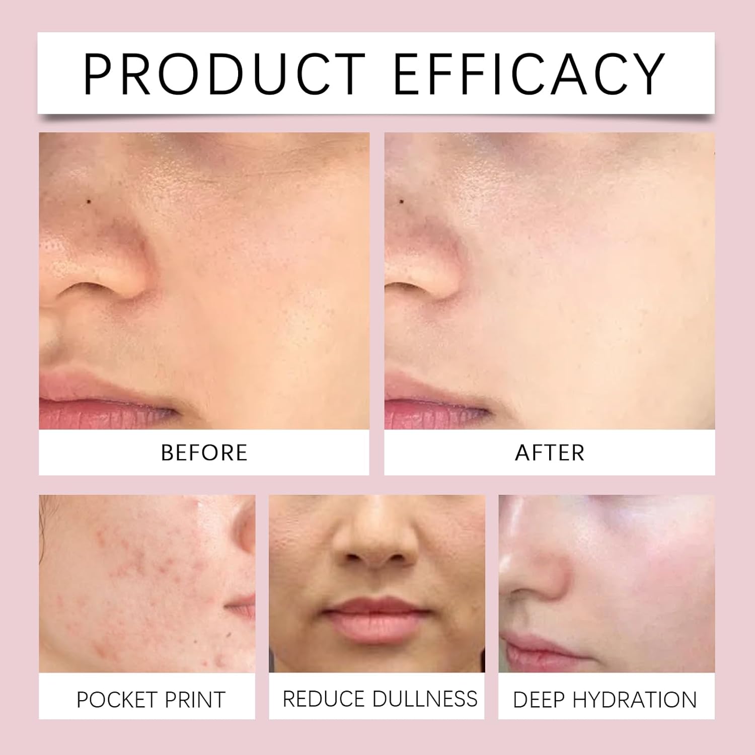 Nicotinamide Facial Spray with Rose, Aloe Extract & Vitamin E, Deep Hydration, Smooth and Hydrated Skin for All Skin Types, 3.38 fl oz - Image 7