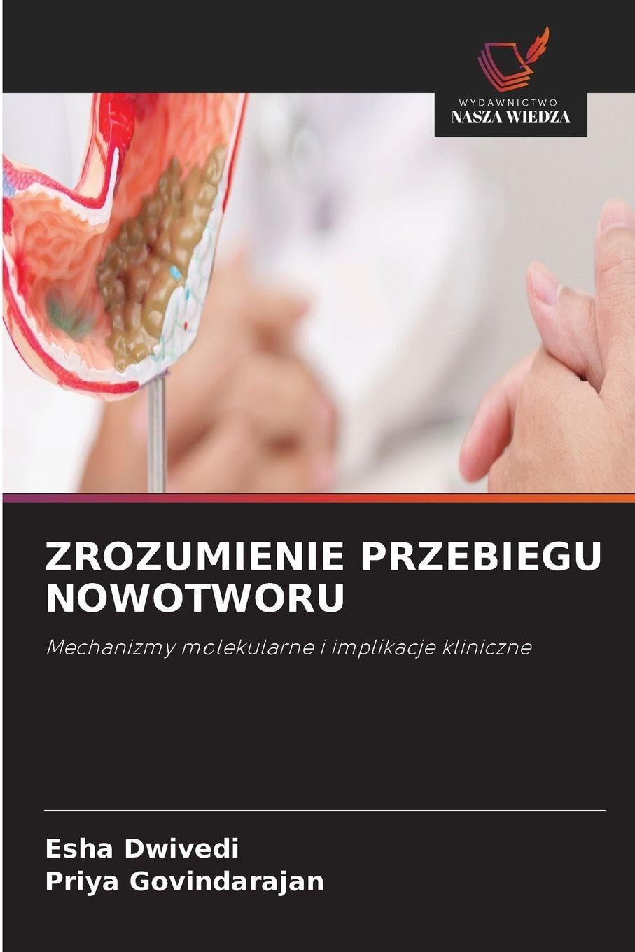 ZROZUMIENIE PRZEBIEGU NOWOTWORU: Mechanizmy molekularne i implikacje kliniczne