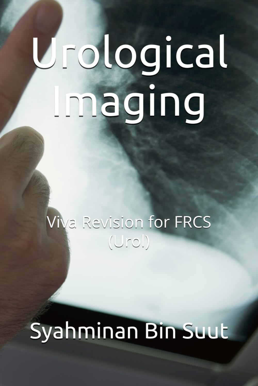 Urological Imaging: Viva Revision for FRCS (Urol)