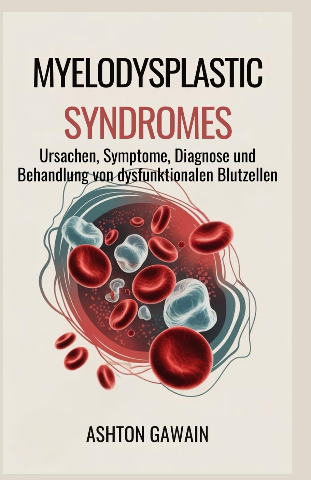 Myelodysplastic Syndromes: Ursachen, Symptome, Diagnose und Behandlung von dysfunktionalen Blutzellen
