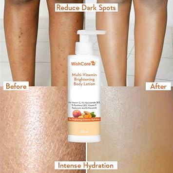 WishCare Multi-Vitamin Body Lotion with Vitamin C, Niacinamide, Panthenol, Vitamin E, Turmeric & Kakadu Plum For Men & Women, 200ml