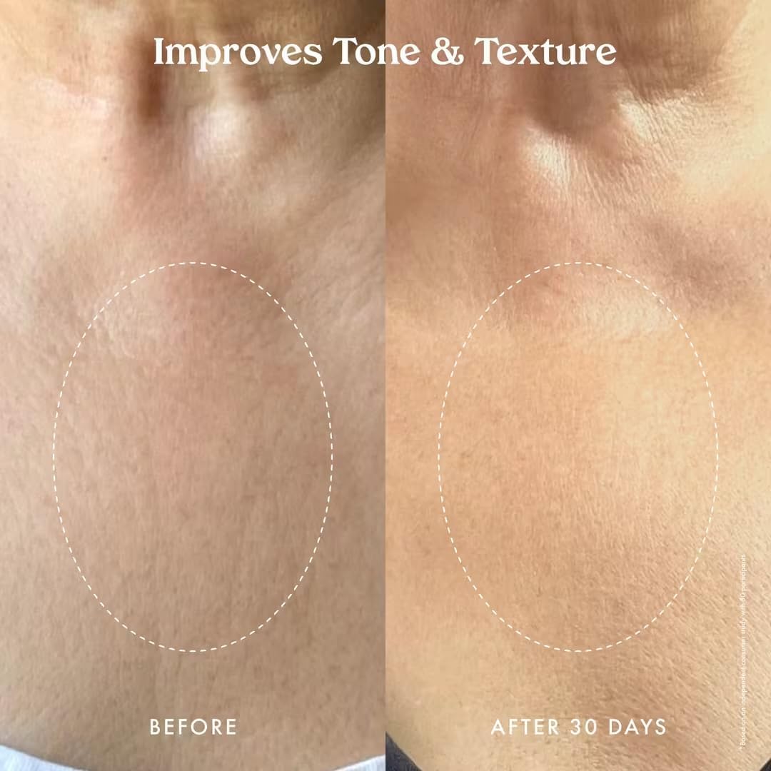 Kopari Ultra Restore Firming Body Serum with Dual Peptide Complex, Deeply Hydrates, Improves Skin Tone & Texture, Firms & Enhances Elasticity, 5 oz image 4 of 8 B0CS4V8MHT