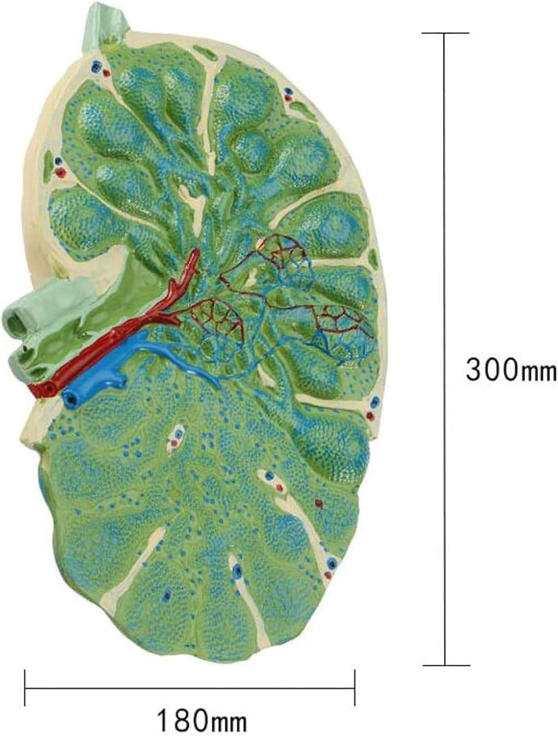 Model anatomiczny powiększenia węzłów chłonnych, model profilu węzła chłonnego, naczynia limfatyczne przecięte wzdłużnie, pokazujące strukturę zastawki, do celów nauczania i prezentacji naukowych.