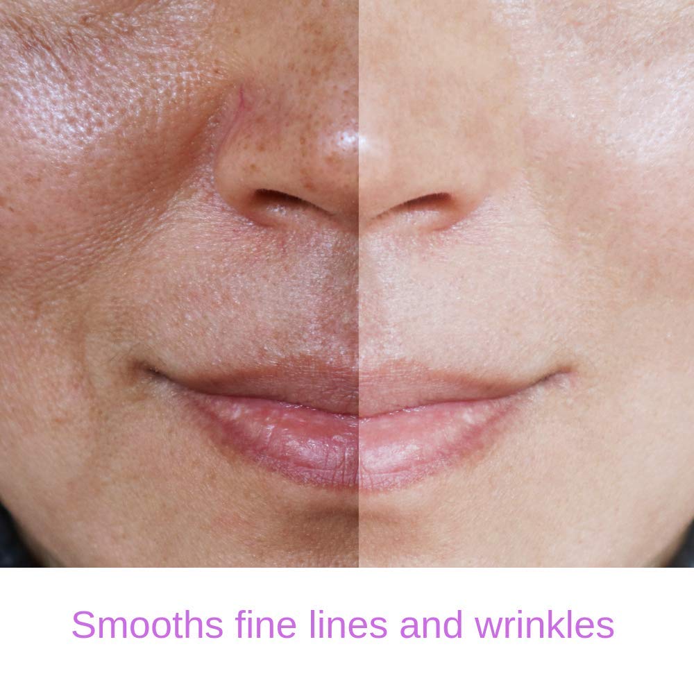 RETINOL Serum 2.5% Professional Anti- Aging Formula With hydrating Hyaluronic Acid and Vitamin E, Minimize Wrinkles - Image 5