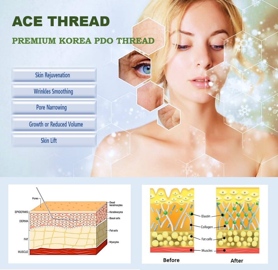 Snapklik.com : UUP ACE PDO Threads Lift For Face And Body, 360 6D Cog ...