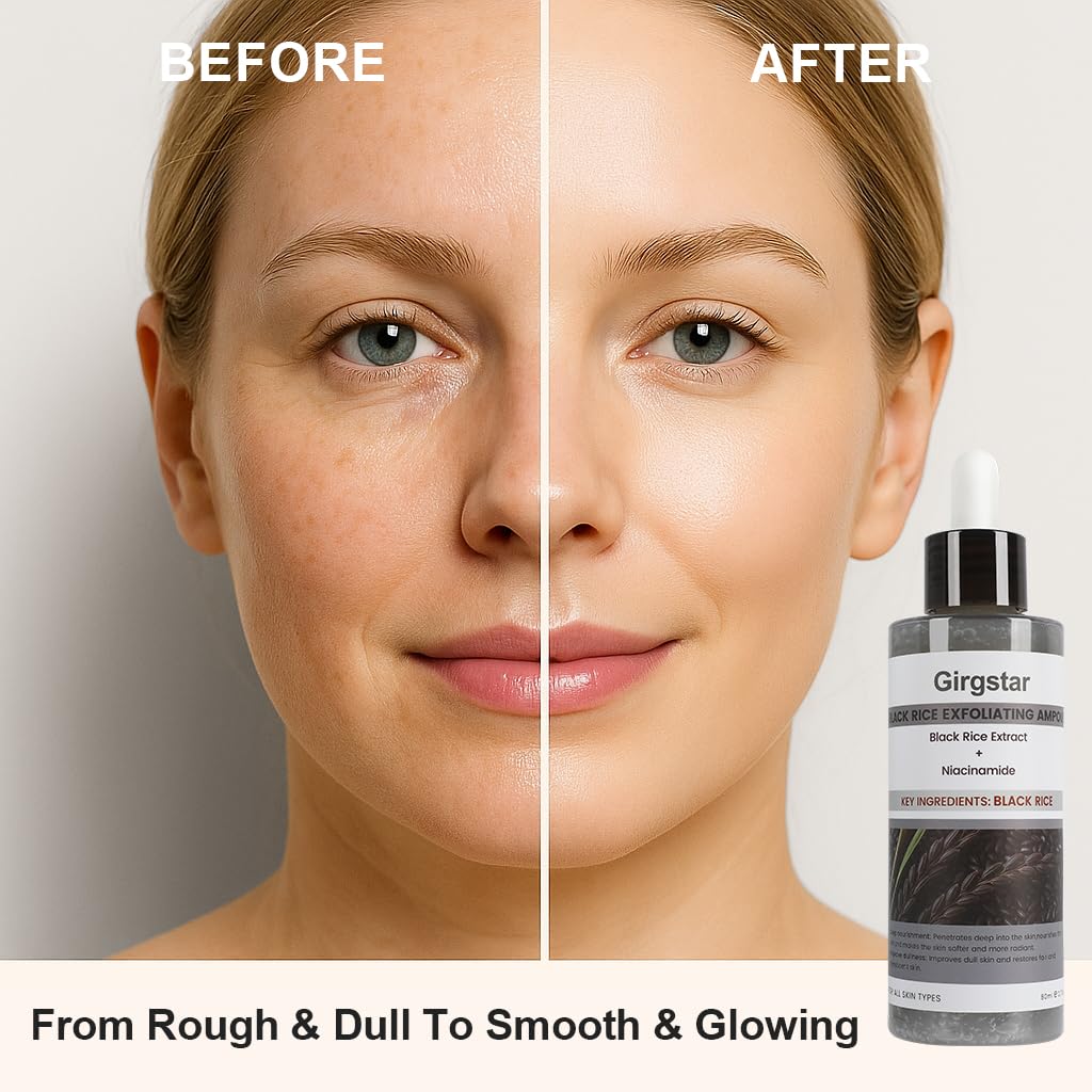 Black Rice Exfoliant Peeling Ampoule 80ml - Gentle Chemical Peel for Face & Pore Cleaner - Hydrating Rice Serum Facial Peels for Blackhead Remover & Daily Skin Care