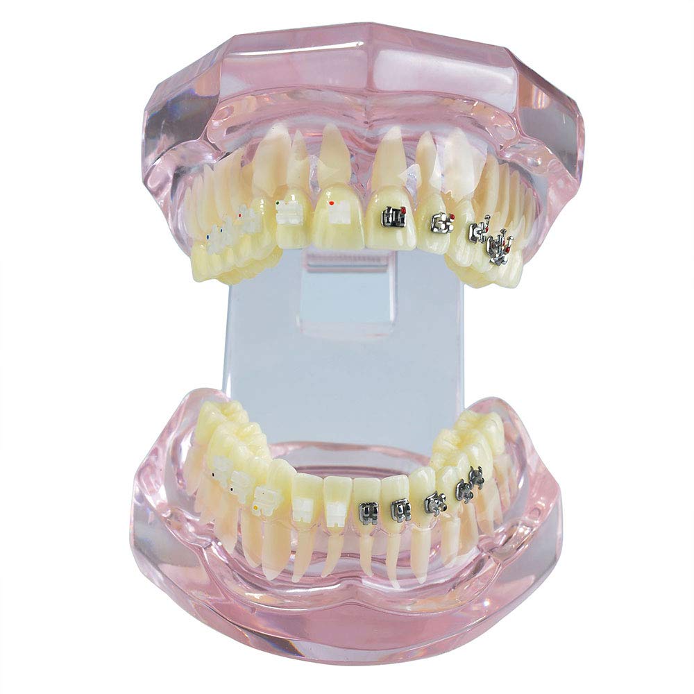 Modello didattico, Modello di denti per apparecchi dentali in metallo e ceramica, Modello ortodontico per adulti dentale Modello di denti dentali Dentista per strumenti di odontoiatria per studio di