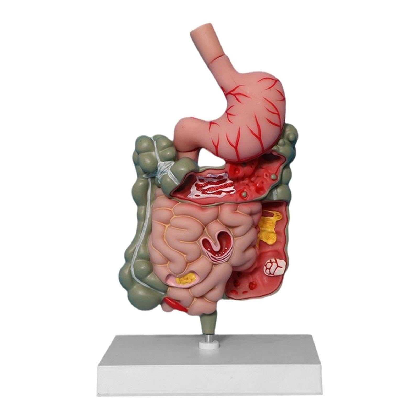 JWQFBC Human Digestive System Model Stomach Section PVC Sturdy Scientific Stomach Model Classroom Science Study Display