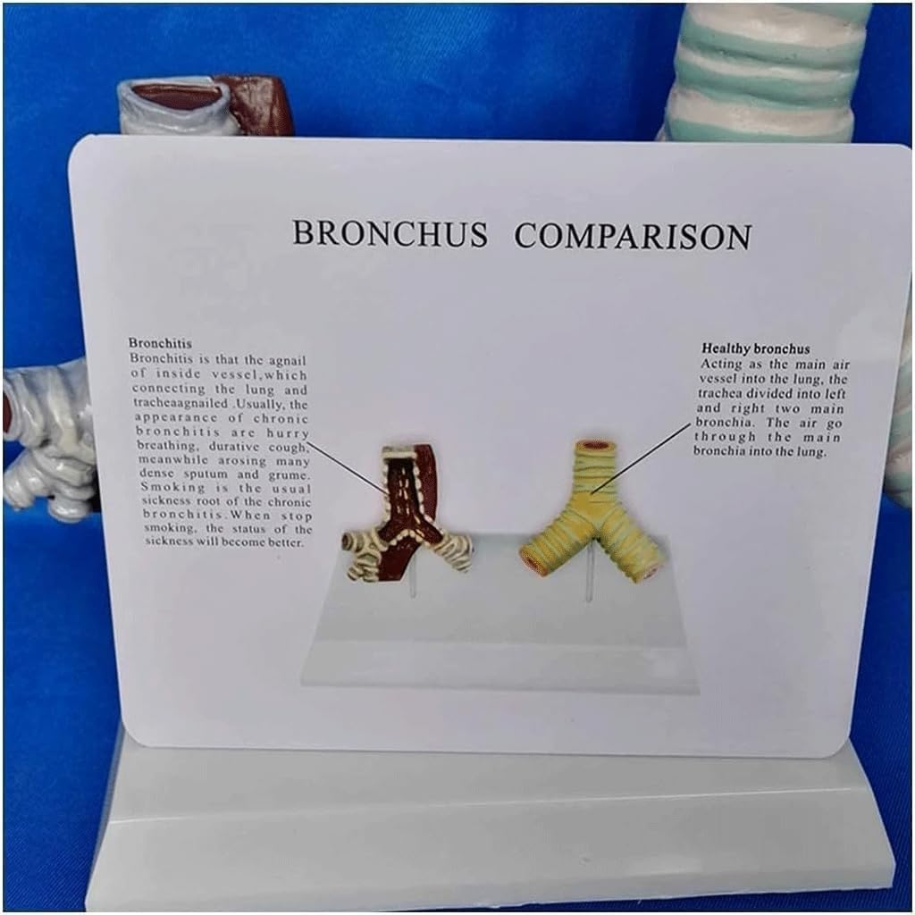Human Trachea Anatomy Model, Smoking Trachea and Normal Trachea Comparison Model, Respiratory System Structure Organ Anatomy, for Medical Teaching Display.