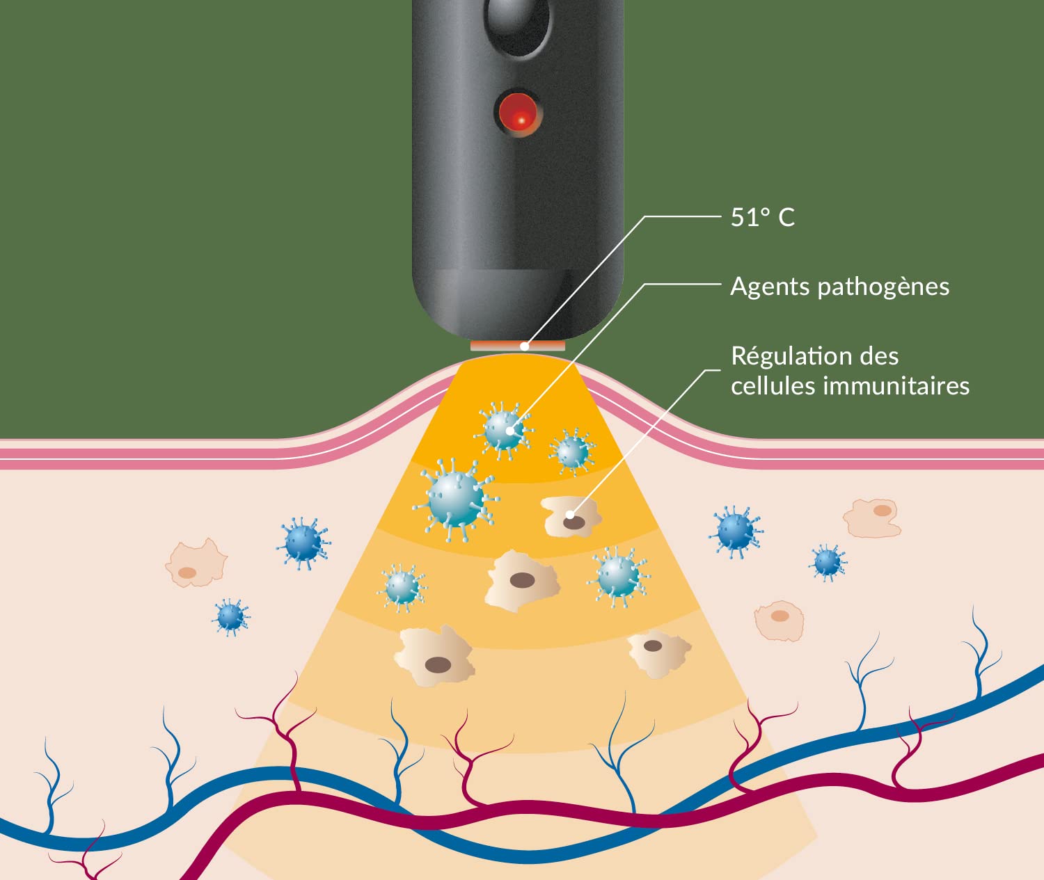 herpotherm® – le stick chauffant contre les boutons de fièvre - traitement sans produits chimiques, agit uniquement par la chaleur