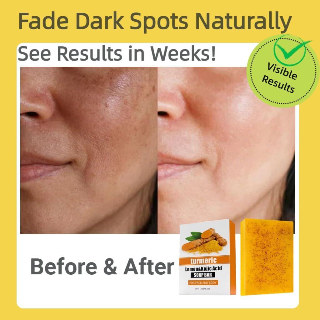 Lemon Turmeric Kojic Acid Soap Bar with Vitamin C, Shea Butter & Amino Acids