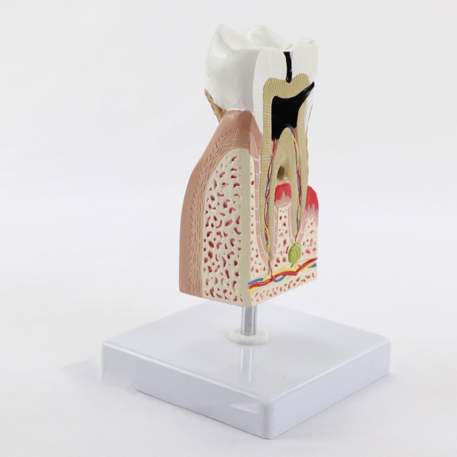 Anatomiczny Model Ludzi, Powiększony Model Opieki Ludzkich, Próchnicy, Próchnicy, Akcesoria Medyczne, Materiał Dydaktyczny, Model Anatomiczny.