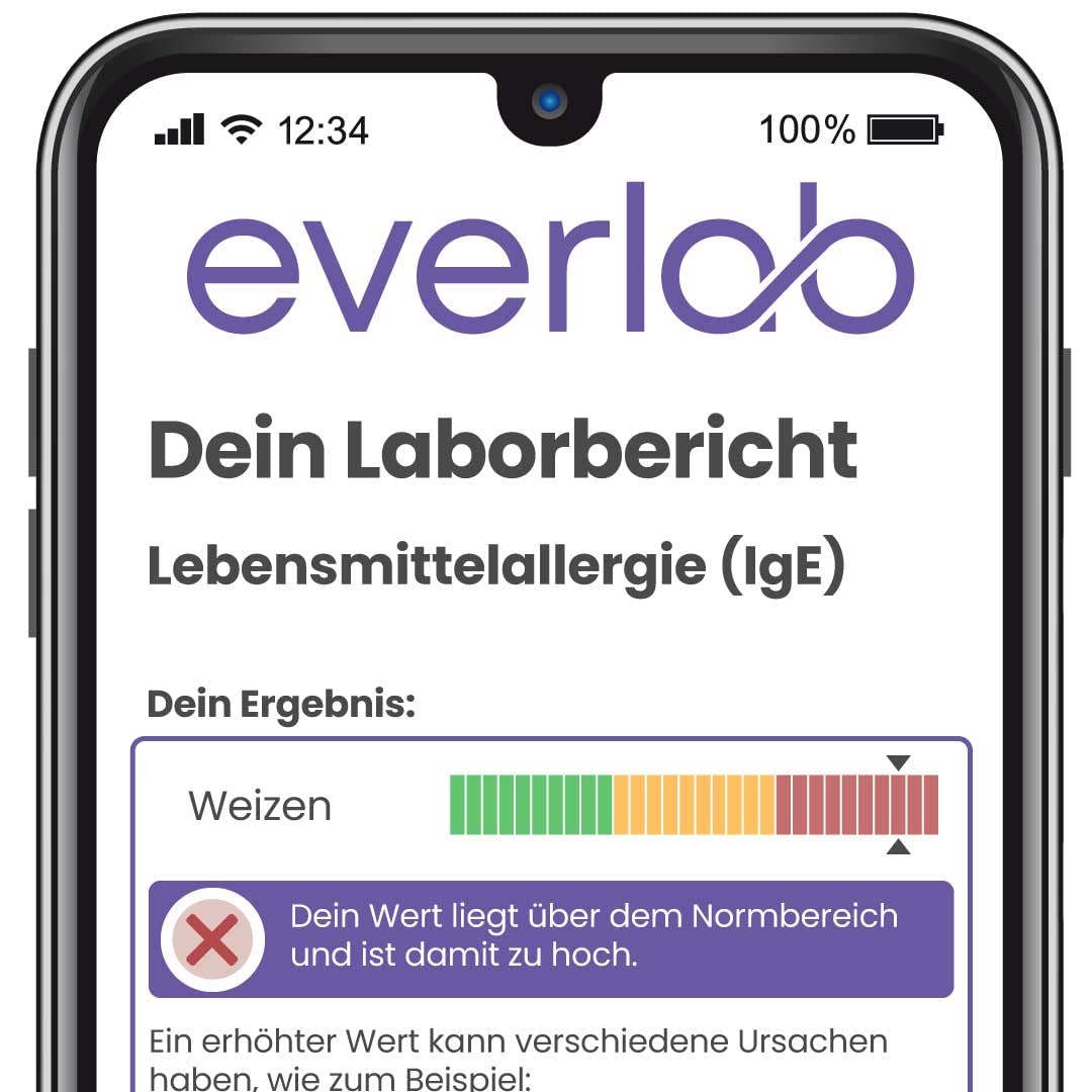 Allergie Check completo – IgE Test su 61 allergeni (cibo, polline, animali, ecc)| Valutazione dettagliata | Auto-test per la casa