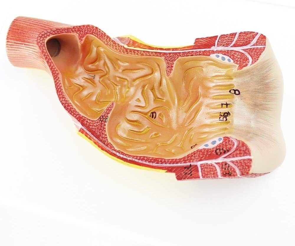 CHROX Modelo De Anatomía Anal Humana En PVC, Modelo Colorrectal En PVC, Cirugía Colorrectal, Cirugía General, Manual De Formación Médica