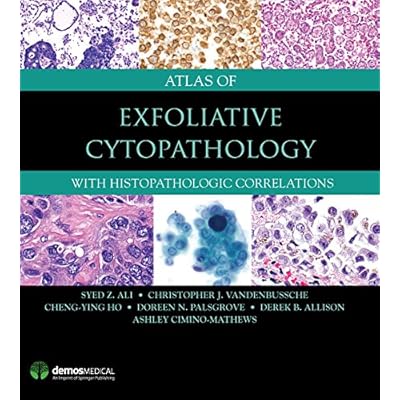 Atlas of Exfoliative Cytopathology: With Histopathologic Correlations