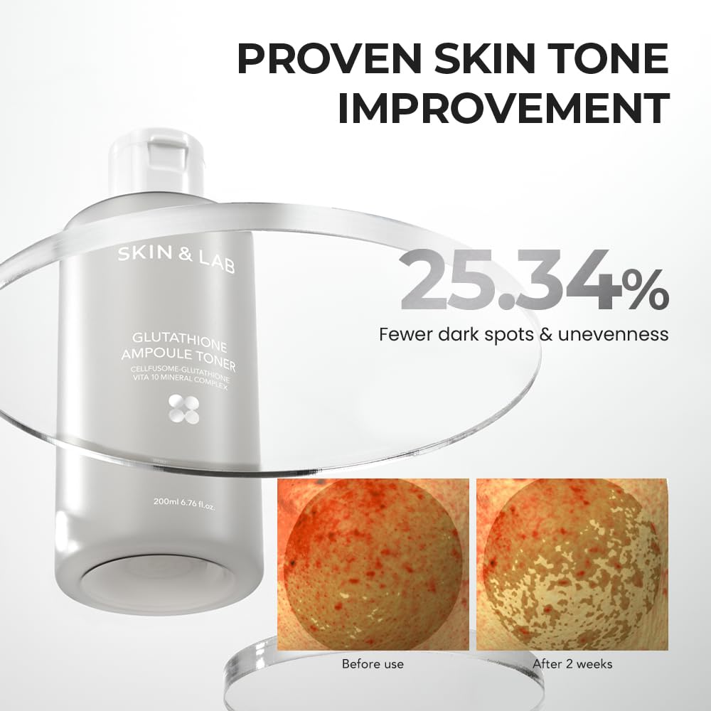 skin&lab glutathione ampoule toner 200ml Amazon.com: [Skin&LAB] Glutathione Ampoule Toner 6.76 fl oz, Improve Dart  Spot, Hyperpigmented, Skin Clarity, Korean Toner for Sensitive Skin :  Beauty & Personal Care