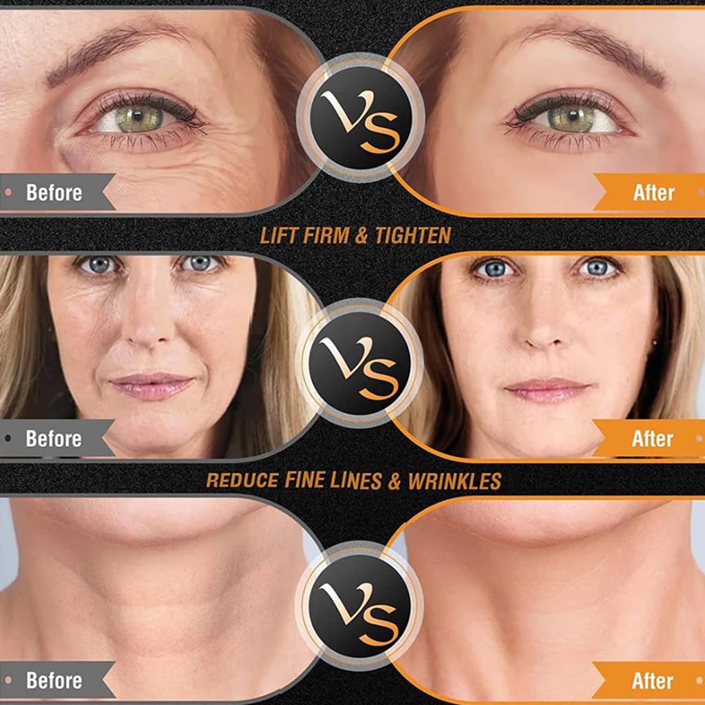 Máquina De Radiofrecuencia Facial Y Corporal, Maquina Radiofrecuencia Facial Profesional, Aparato Radiofrecuencia Facial Y Corporal, Facial Aparato RF Para El Rejuvenecimiento De La Piel