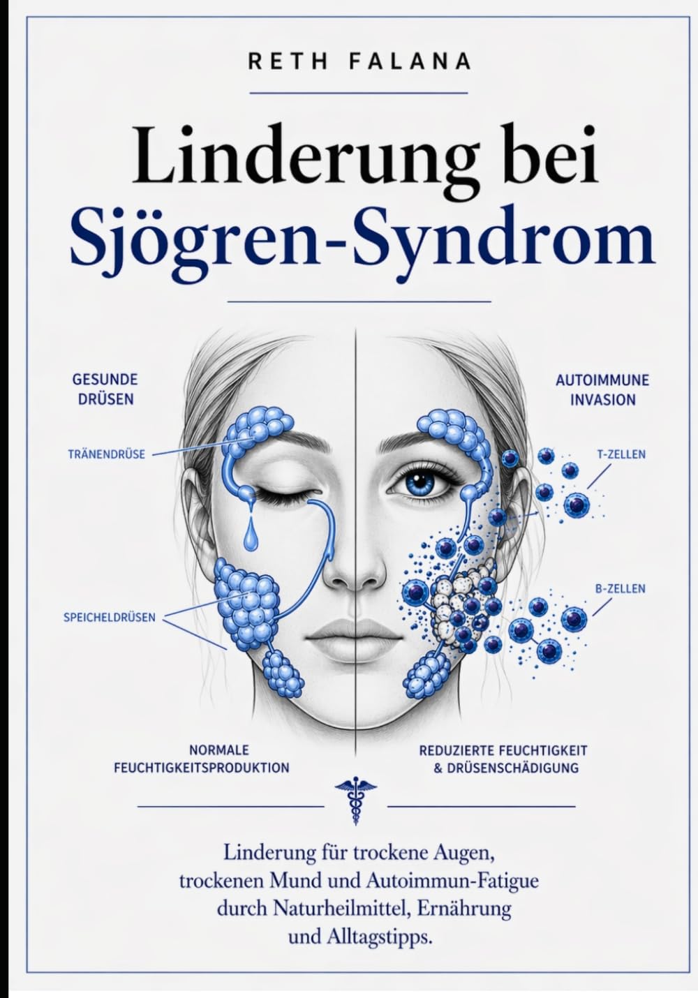Linderung bei Sjögren-Syndrom: Linderung für trockene Augen, trockenen Mund und Autoimmun-Fatigue durch Naturheilmittel, Ernährung und Alltagstipps.