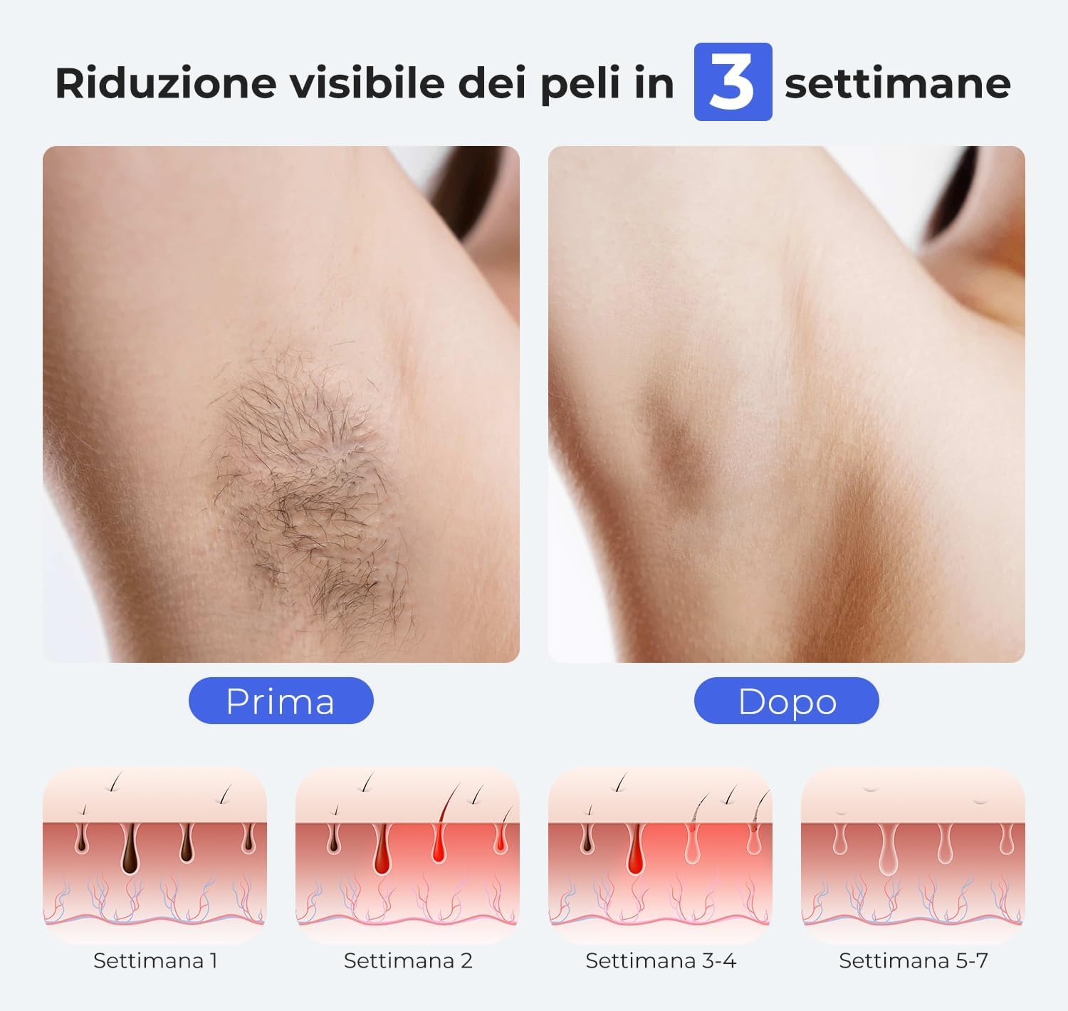 Epilatore Luce Pulsata IPL con tecnologia 360°Frost 5°C Sapphire, Epilazione laser indolore con APP Smart AI, 24J & 15 livelli di energia e flash a velocità 2X, per Donna e Uomo ascelle, corpo, bikini