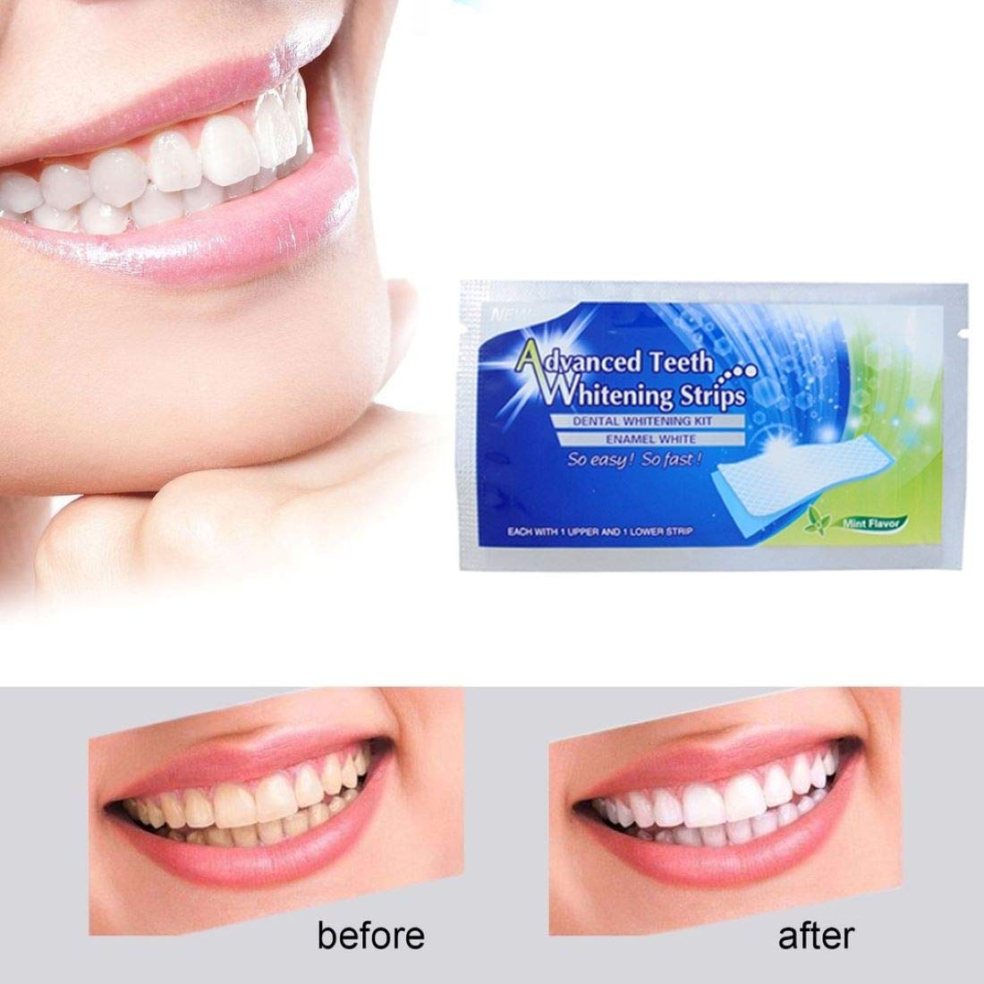 Digital Shoppy Ever White Advanced Professional Teeth Whitening Strips 28 Pieces 2
