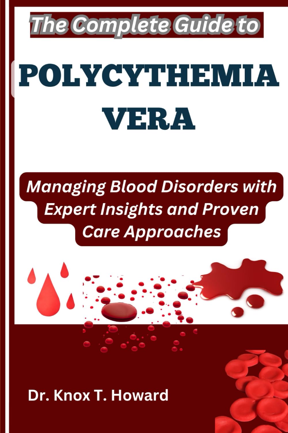 The Complete Guide to Polycythemia Vera: Managing Blood Disorders with Expert Insights and Proven Care Approaches
