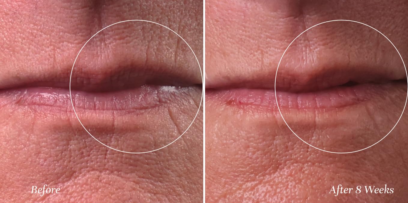 City Beauty City Lips Line Therapy - Lip Line Fortifying Treatment - Defining & Smoothing - Solution for Lipstick Lines, Vertical Wrinkles, Corner Creases - Anti-Aging Cruelty-Free Skin Care