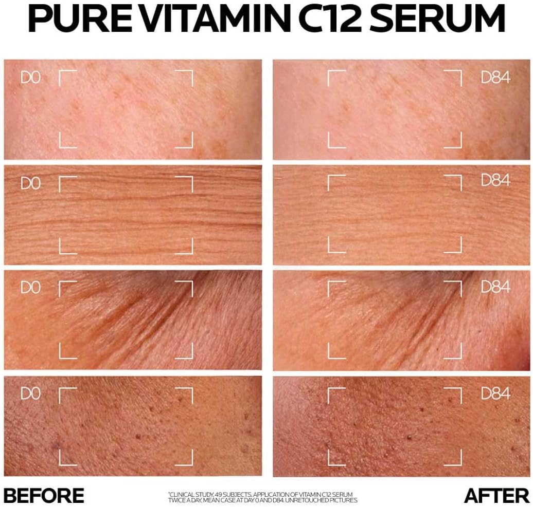 سيروم الوجه La Roche Posay 12% فيتامين C مع حمض الهيالورونيك 30ML