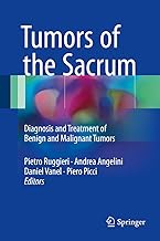 Tumors of the Sacrum: Diagnosis and Treatment of Benign and Malignant Tumors