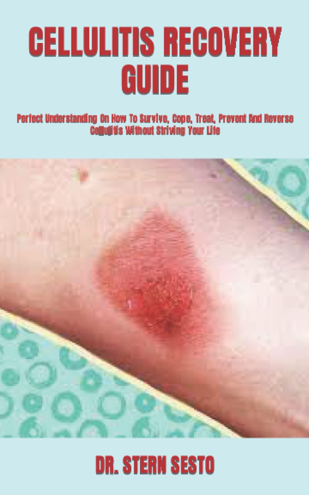 Buy CELLULITIS RECOVERY GUIDE Perfect Understanding On How To Survive