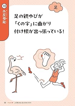 爪 基礎から臨床まで 改訂第2版 71tKLaaRr+L.jpg_BO30,255,255,