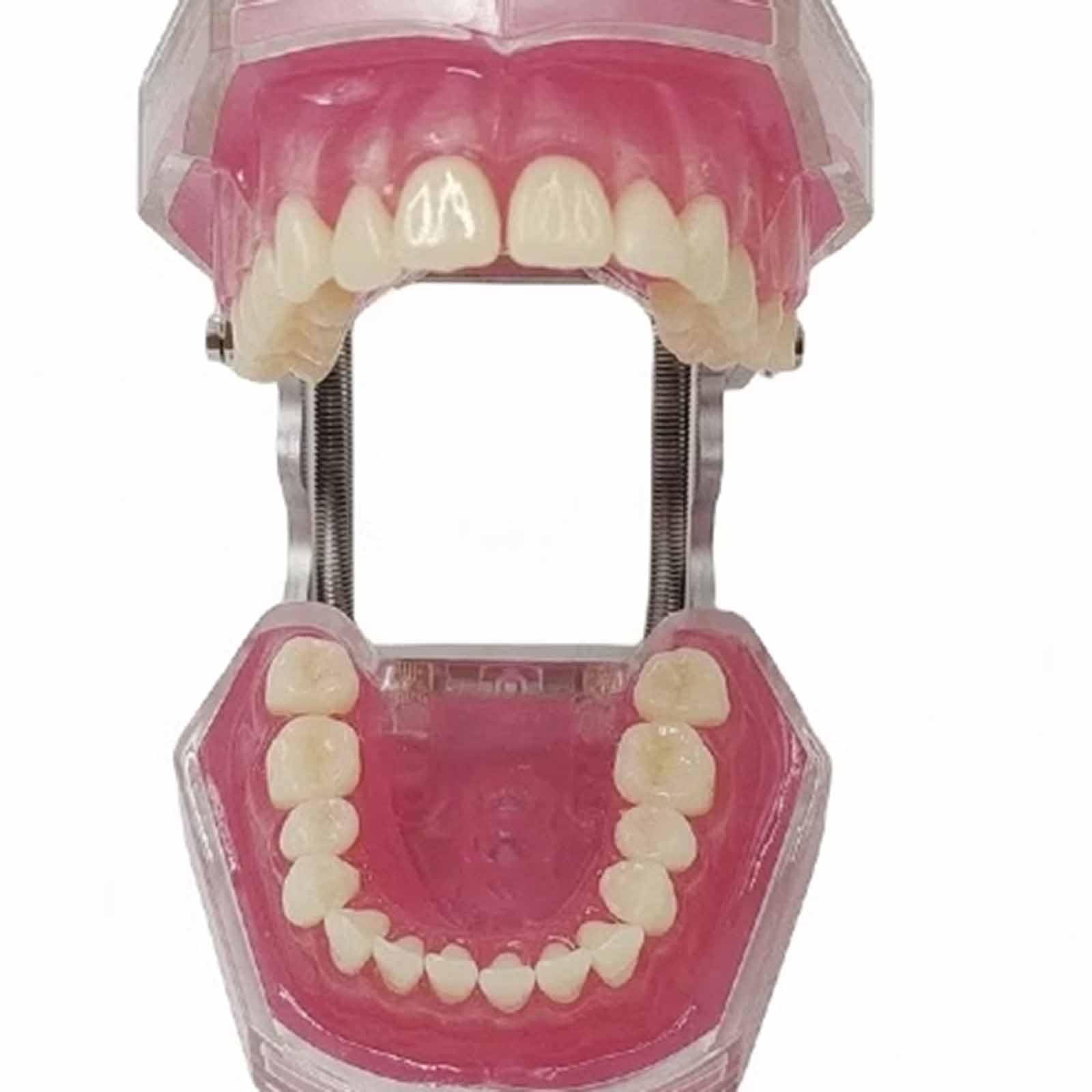 Model Demonstracyjny Zębów Dentystycznych, Model Z Wyjmowanymi Miękkimi Dziąsłami Do Nauki, Model Dydaktyczny Dla Dorosłych (Różowy, 8 Cm),Pink-8cm
