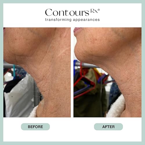 Miniatura 7 de Contours Rx Neck Rescue - Tiras de cuello antienvejecimiento para piel crepé - Aprieta, levanta y reafirma las líneas finas y arrugas - Tratamiento