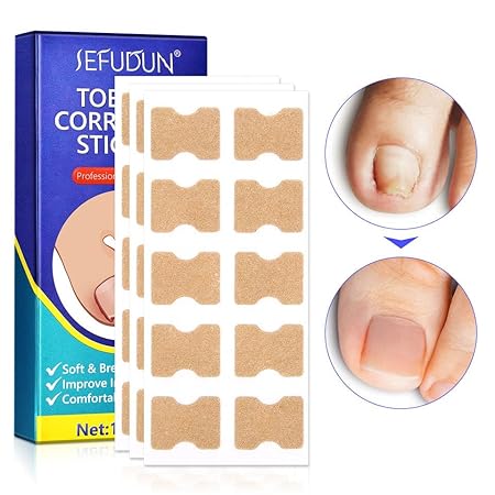 clean living® 100 pcs Ingrown Toenail Sticker, Nail Correction Patches,Professional Nail Correction Sticker, Foot Care Tool With Nail File And Cuticle Pusher