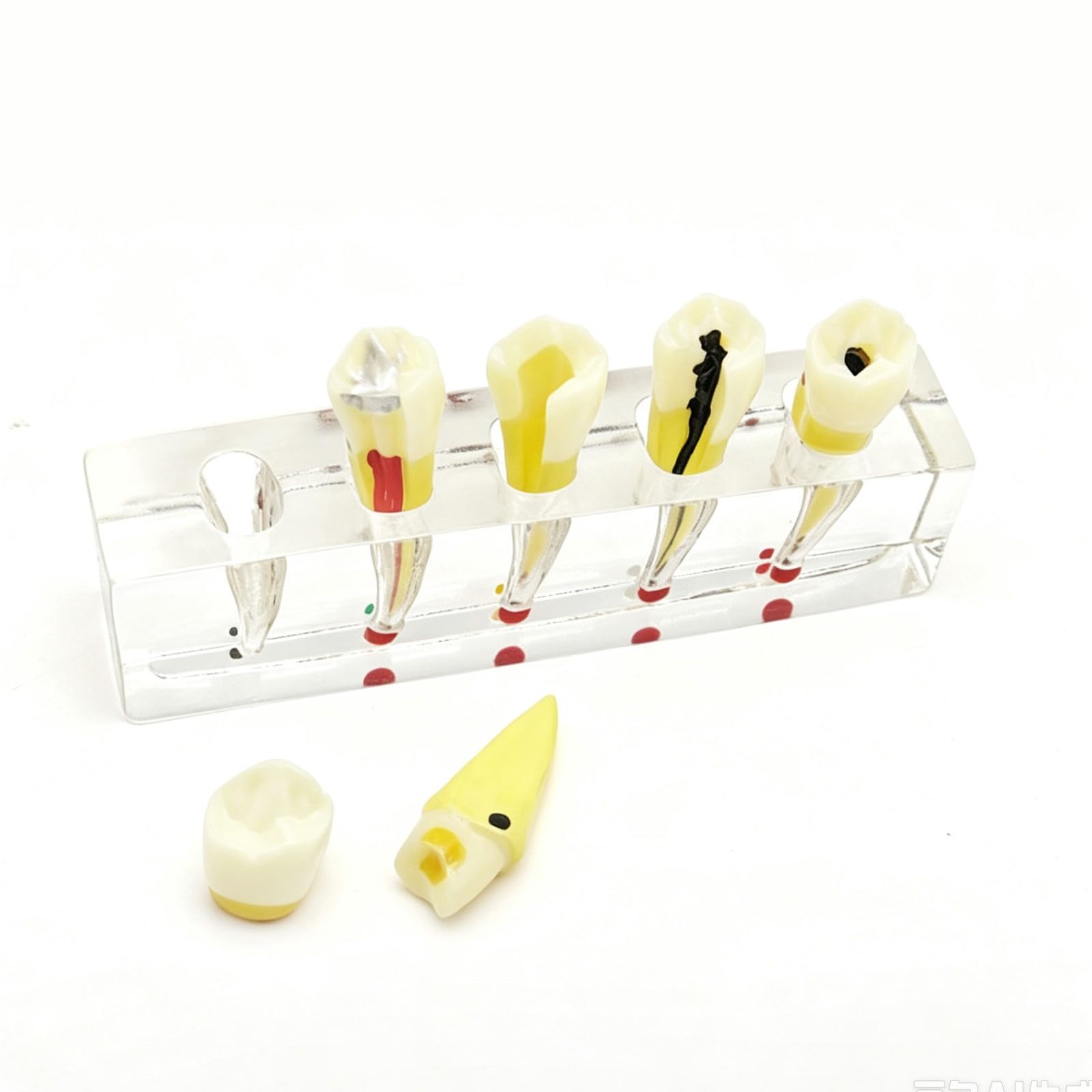 Modèle d'implant dentaire pour l'éducation du patient, modèle de traitement endodontique/démonstration d'anatomie canalaire, modèles de dents pédagogiques pour la démonstration