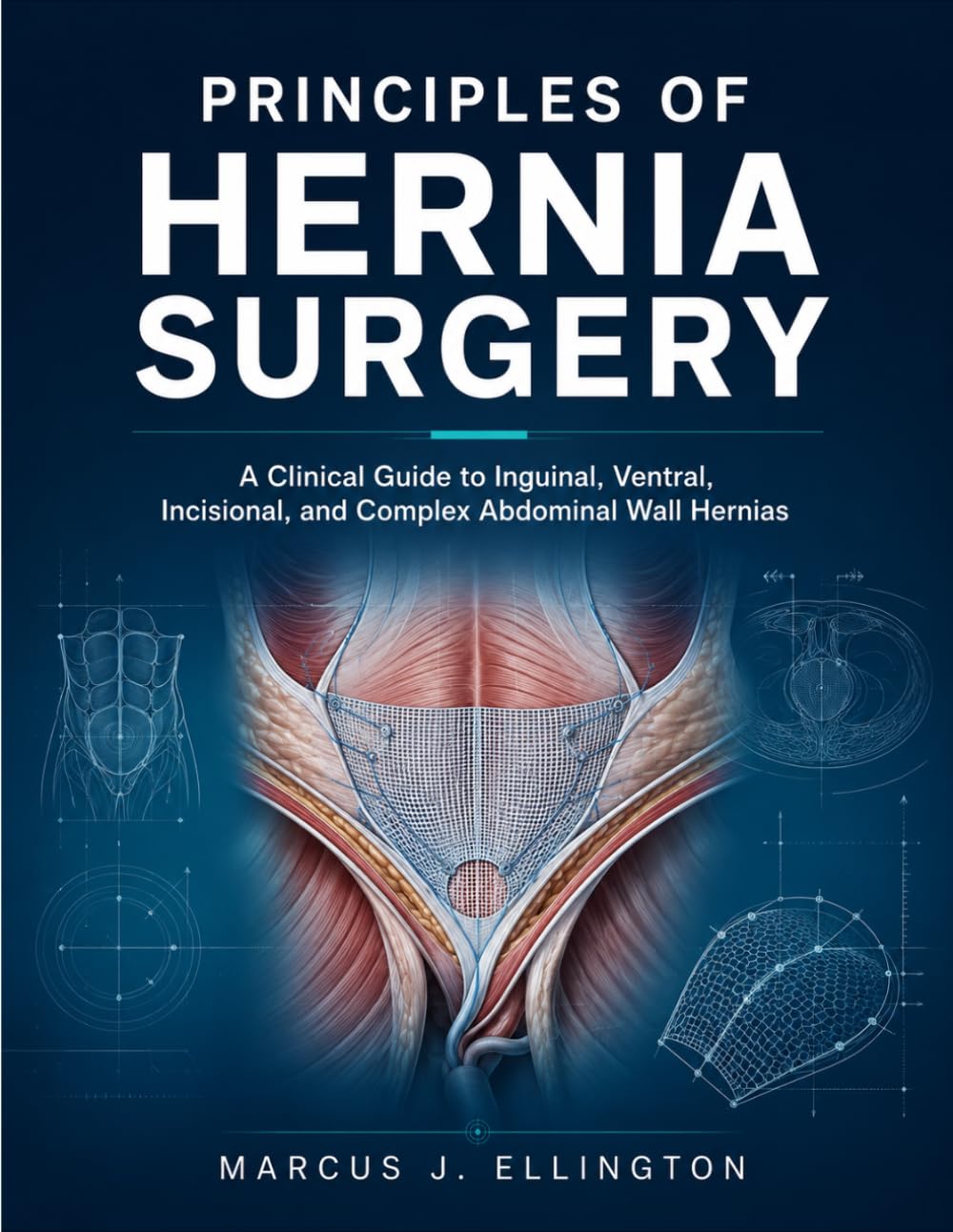 PRINCIPLES OF HERNIA SURGERY: A Clinical Guide to Inguinal, Ventral, Incisional, and Complex Abdominal Wall Hernias