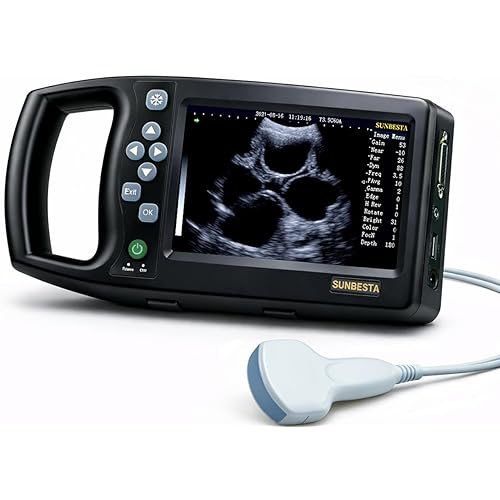 A8 Portable Veterinary Ultrasound Machine for Pregnancy Check, 5.7” HD Display,Beginner-Friendly Handheld Scanner for Dogs, Sheep,Pigs & Small Farms,with Waterproof Probe &Carrying Case (Convex Probe)