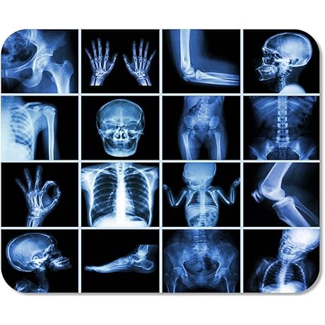 X-Ray Pad: Human Bone Anatomy Mousepad for Educational Desk Comfort