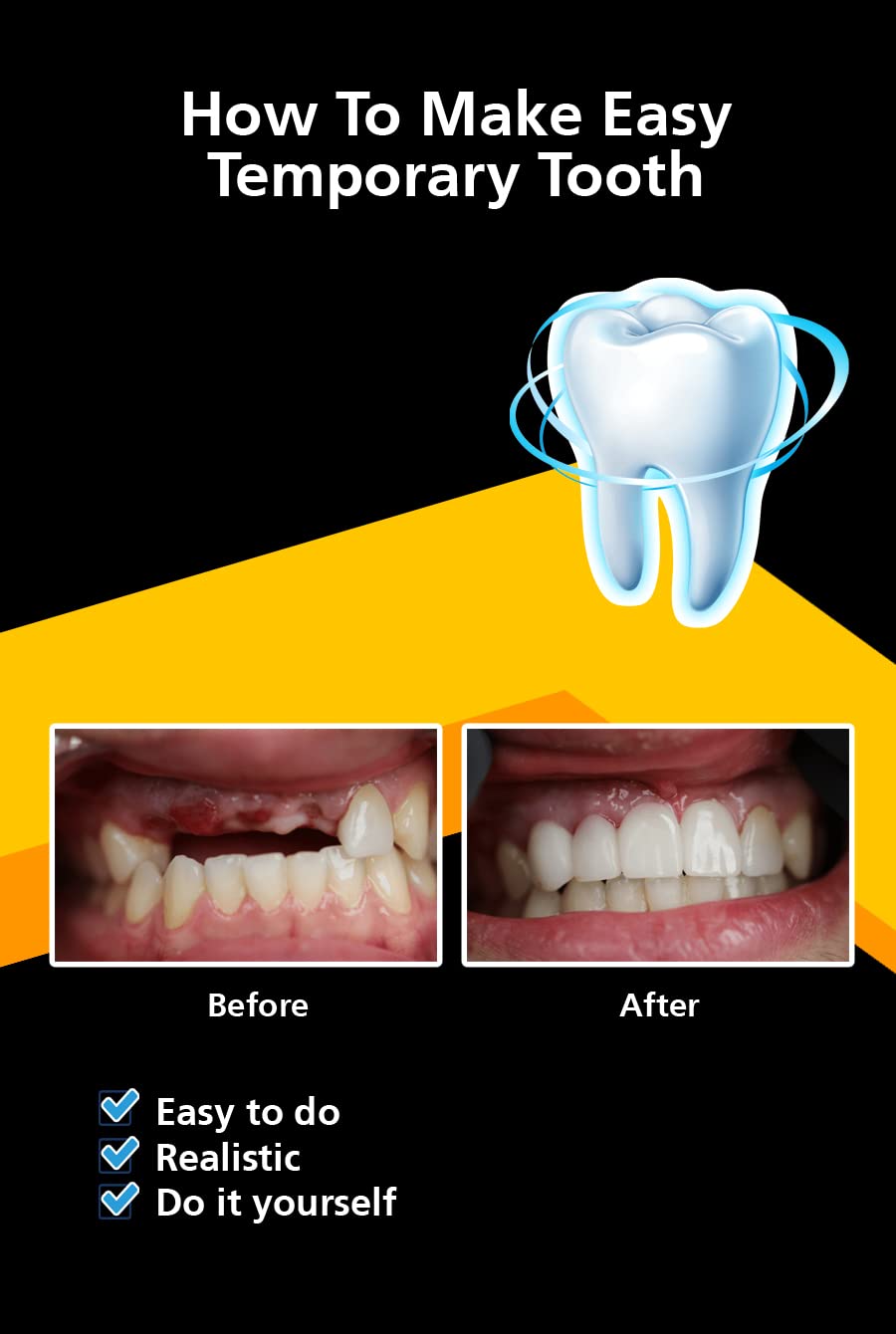 How To Make Easy Temporary Tooth Temptooth Temporary Tooth Replacement