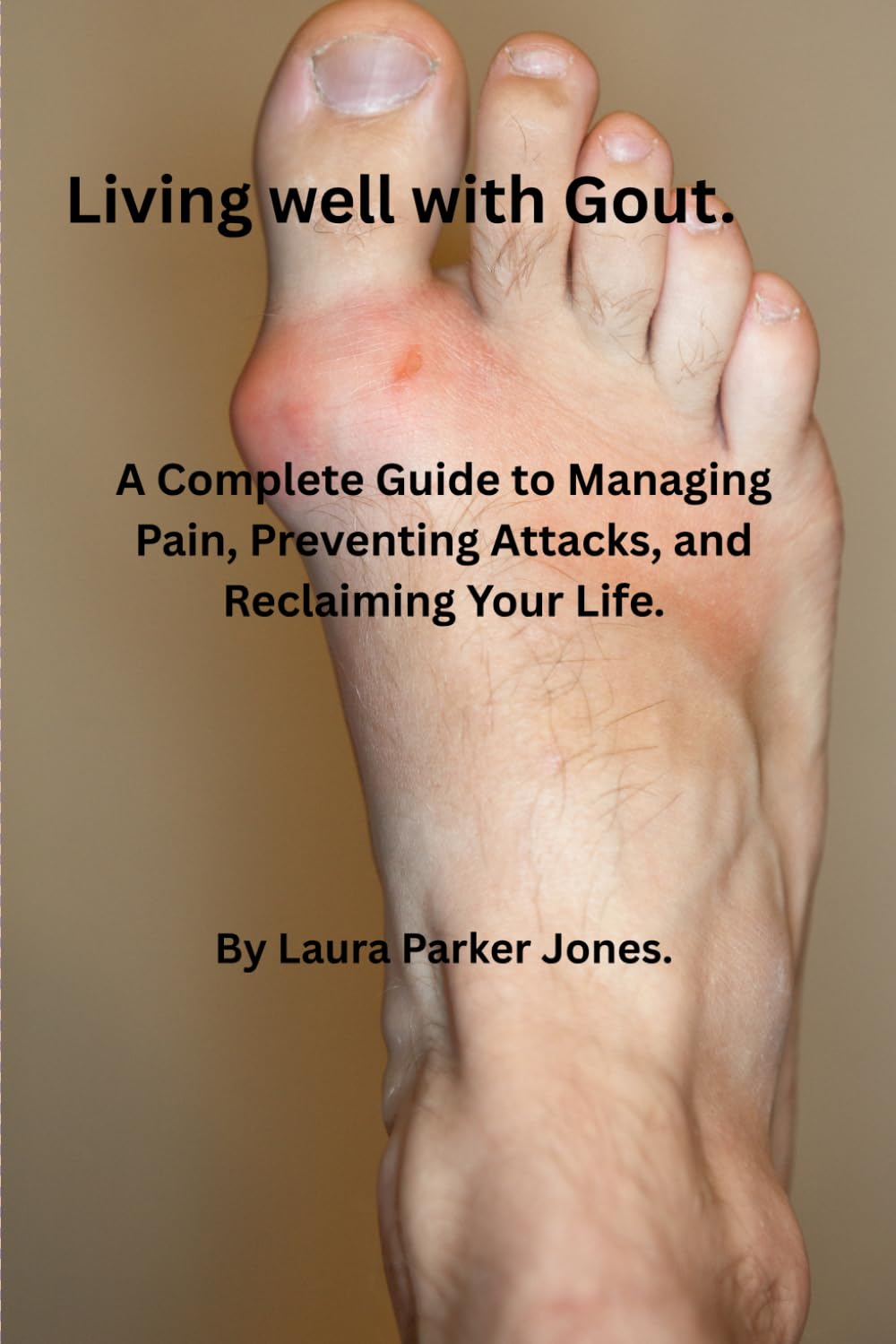 Living Well with Gout.: A Complete Guide to Managing Pain, Preventing Attacks, and Reclaiming Your Life. (How to live a better life with arthritis)
