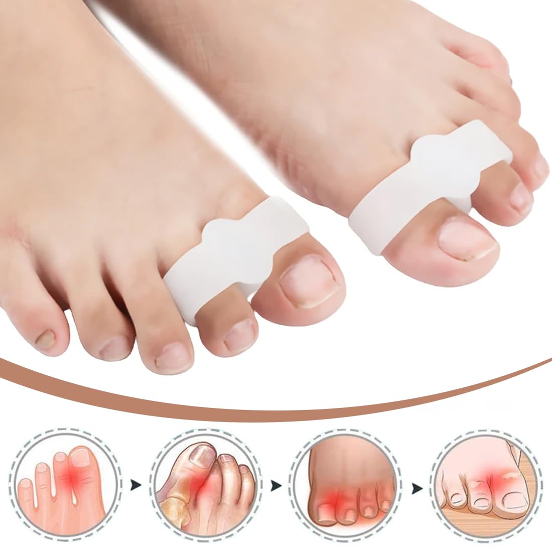 8 manicotti unisex per alluce valgo (due paia di alluci e due paia di mignoli) per prevenire il dolore all'alluce valgo, correggere le dita dei piedi e le dita a martello (bianco + tono della pelle)