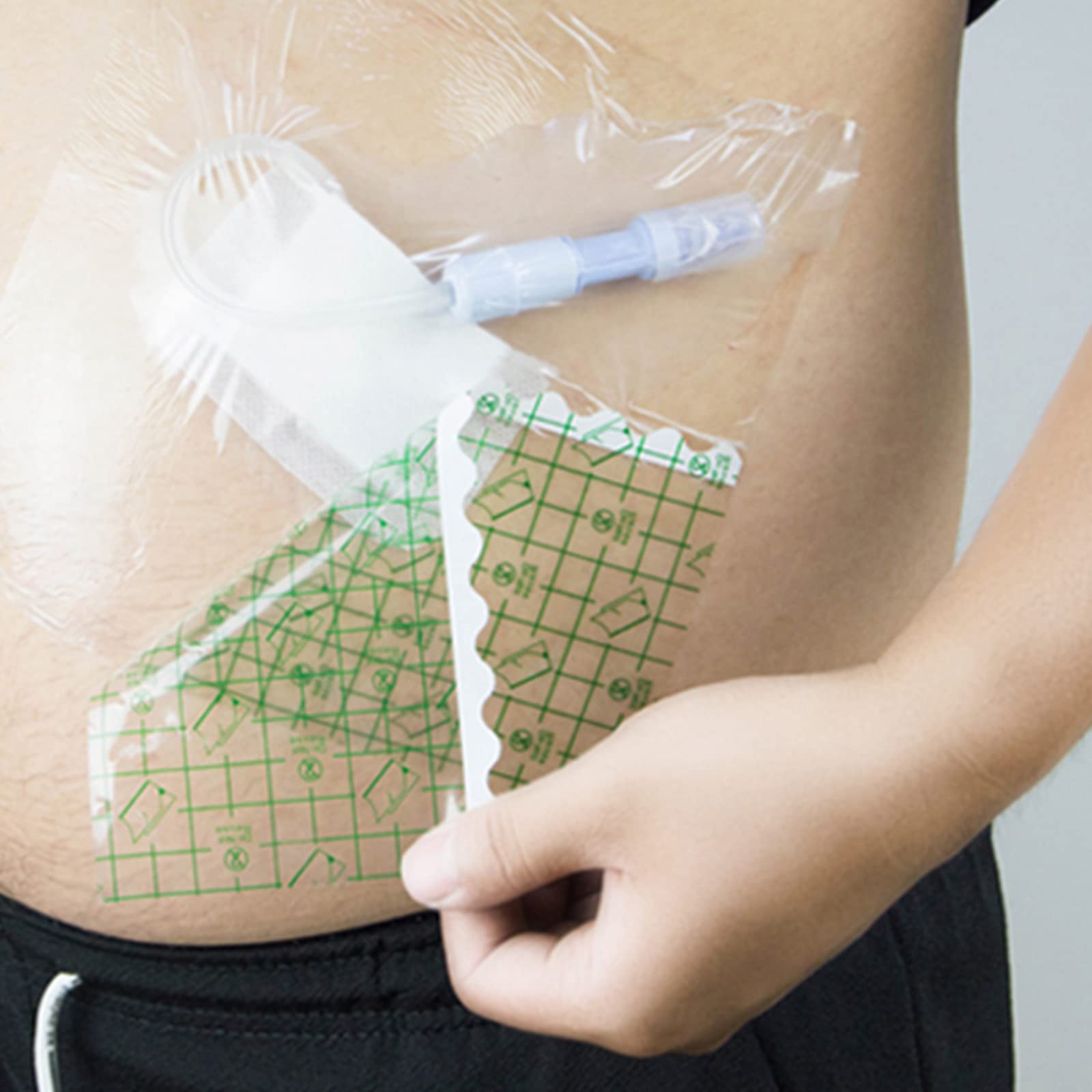 Protettore Per Doccia Per Dialisi Peritoneale, Accessorio Per La Pelle Di Fissaggio Con Pellicola Trasparente, Cerotto Per Dialisi Peritoneale Impermeabile Per Porta Di Dialisi,100pcs