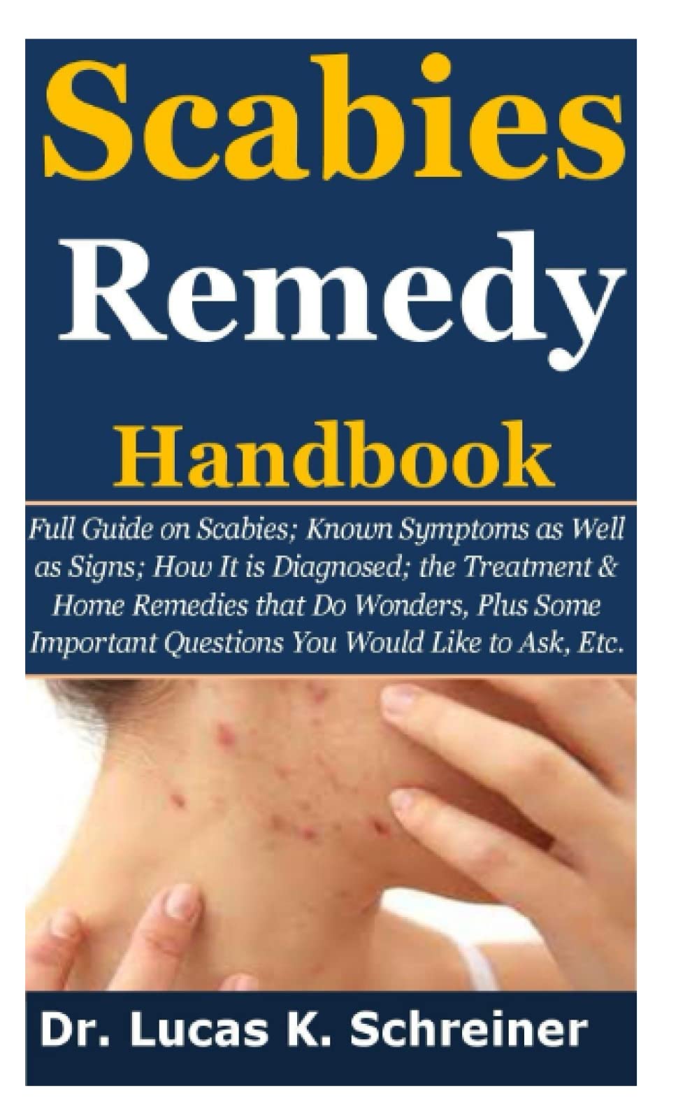 Scabies Remedy Handbook: Full Guide on Scabies; Known Symptoms as Well as Signs;How It is Diagnosed;the Treatment&Home Remedies that Do Wonders,Plus Some Important Questions You Would Like to Ask,Etc.