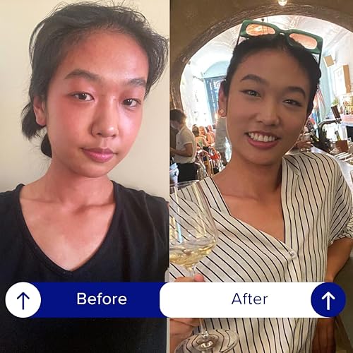 Miniatura 5 de Asian Flush Gel - 16 geles de naranja, impulsado por vitaminas y antioxidantes, rápido, eficaz y respaldado por la ciencia