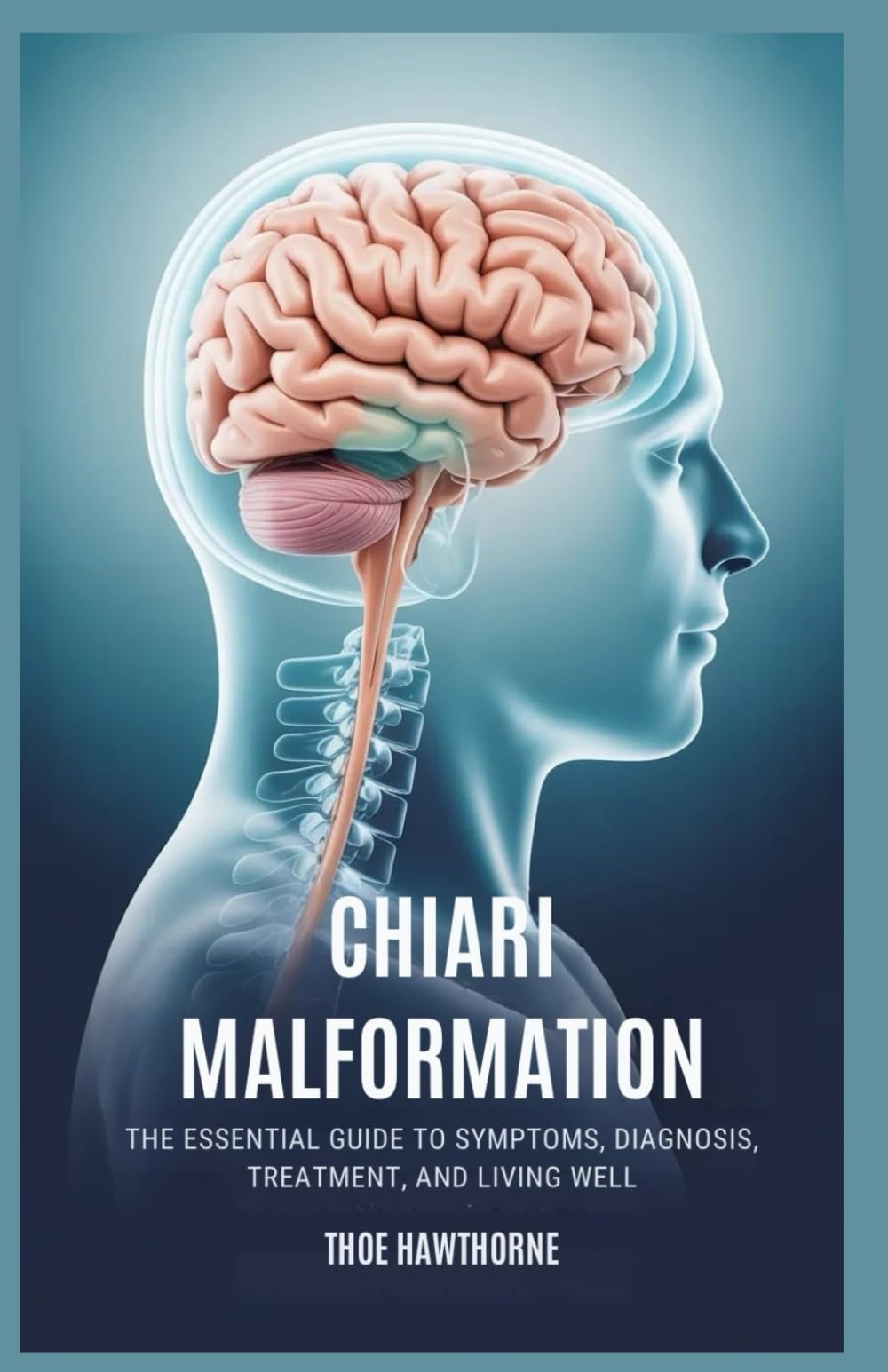 Chiari Malformation: The Essential Guide to Symptoms, Diagnosis, Treatment, and Living Well