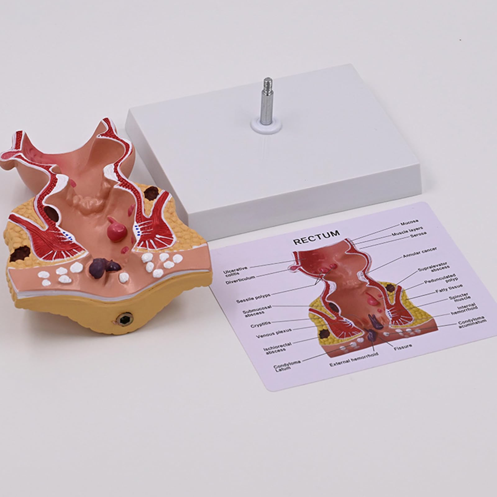 Modello retto per anatomia aiuto didattico patologie umane pratiche del retto modello di materiale scolastico umano per anatomia