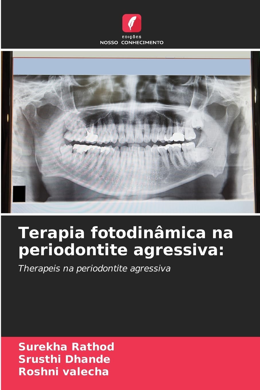 Terapia fotodinâmica na periodontite agressiva:: Therapeis na periodontite agressiva