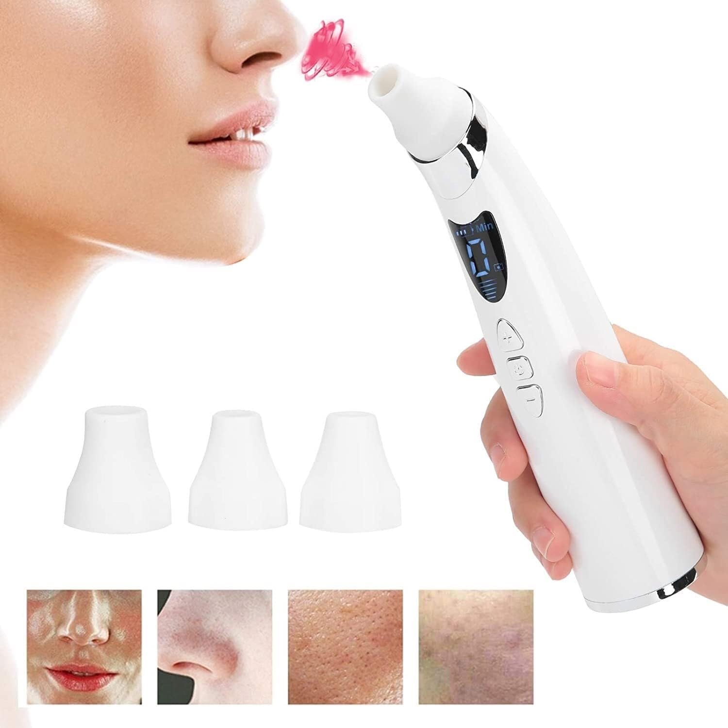 Aspirapolvere, Macchina for la rimozione visiva dei Punti Neri Aspirapolvere Pulitore for pori Aspiratore Punti Neri Aspirapolvere for pori Aspirazione Rimozione dell'acne Detergente Elettrico